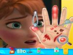 Anna Frozen Hand Physician: Jocuri distractive pentru fete online